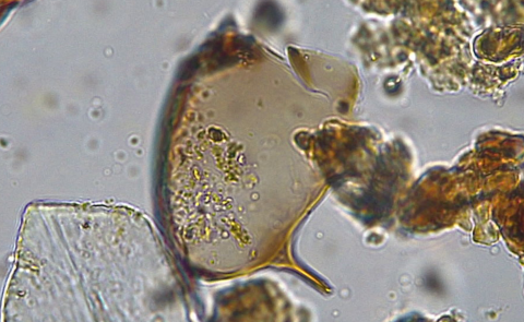 Schistosoma mansoni eitje